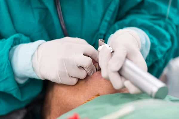 تصویر 5 از خرید و فروش ایروی تجهیزات پزشکی با شرایط فوق العاده